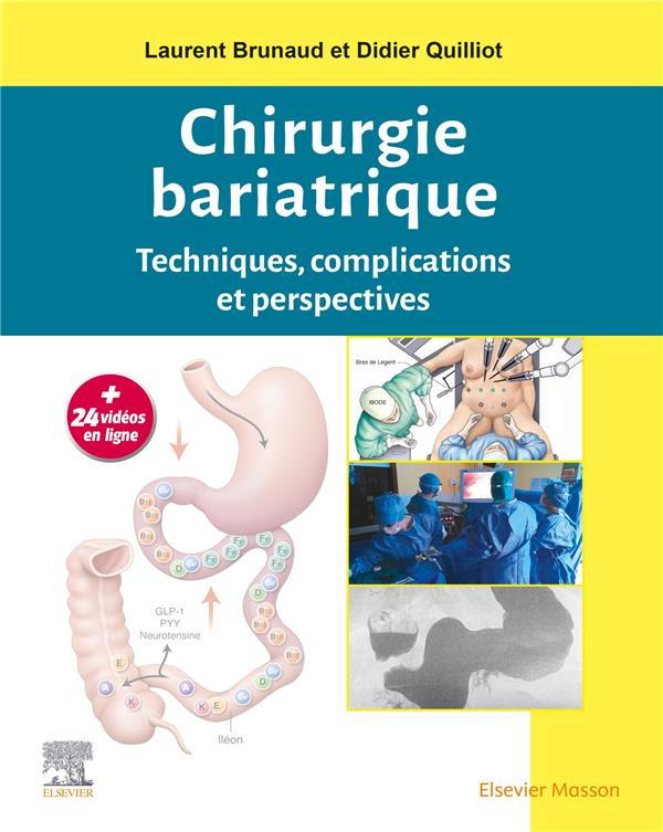 Chirurgie bariatrique. Techniques, complications et perspectives