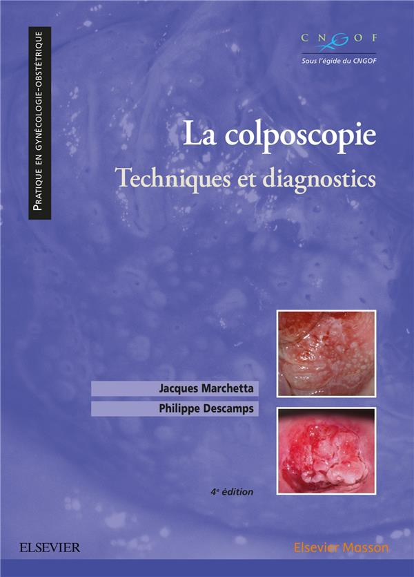 La colposcopie. Techniques et diagnostics, 4e édition
