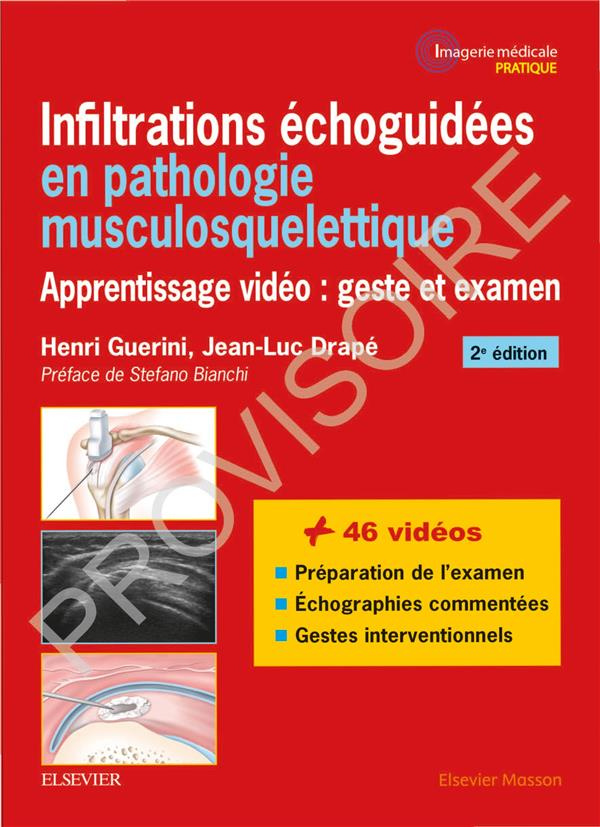 Infiltrations échoguidées en pathologie musculosquelettique. Apprentissage vidéo : geste et examen,