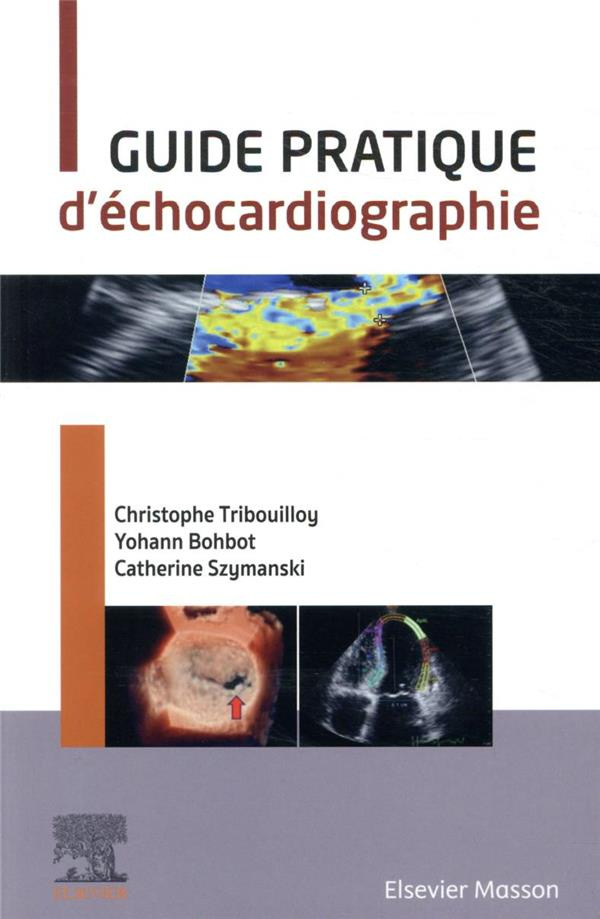 Guide pratique d'échocardiographie