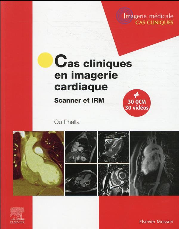 Cas cliniques en imagerie cardiaque. Scanner et IRM