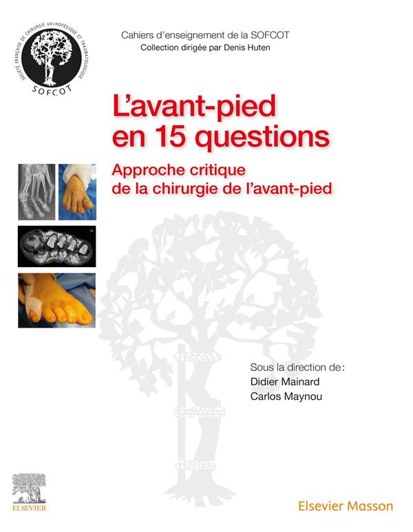 L'avant-pied en 15 questions. Approche critique de la chirurgie de l'avant-pied