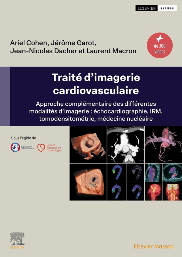 Traité d'imagerie cardiovasculaire. Approche complémentaire des différentes modalités d'imagerie : é