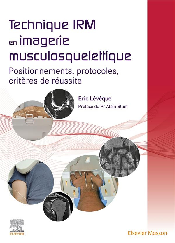 Technique IRM en imagerie musculosquelettique. Positionnement, protocoles, critères de réussite