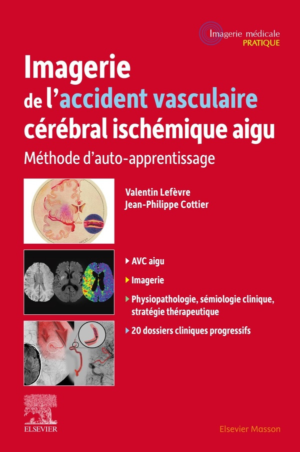 Imagerie de l'accident vasculaire cérébral ischémique aigu. Méthode d'auto-apprentissage