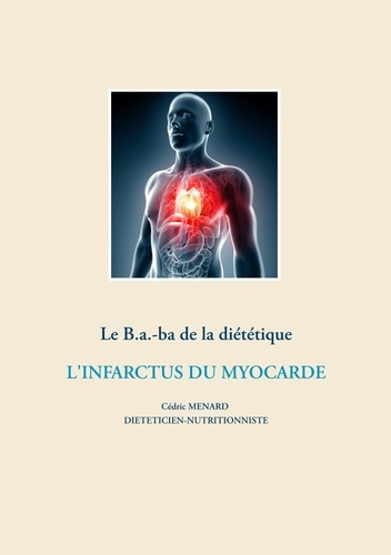 Le B.a.-ba de la diététique. L'infarctus du myocarde