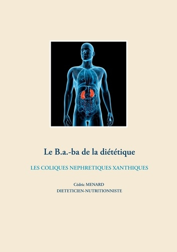 Le b.a-ba de la diététique pour les coliques néphrétiques xanthiques