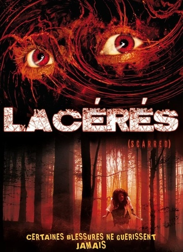 LACERES
