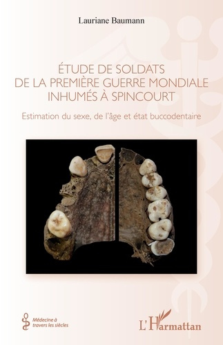 Etude de soldats de la Première Guerre mondiale inhumés à Spincourt. Estimation du sexe, de l'âge et