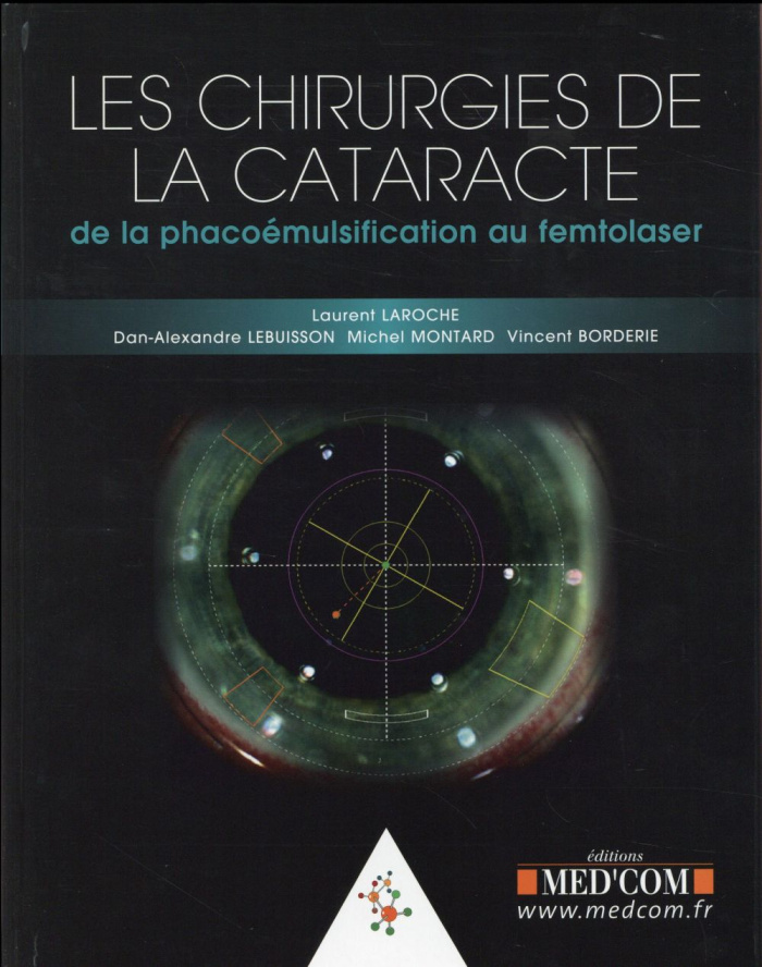 Les chirurgies de la cataracte. De la phacoémulsification au femtolaser