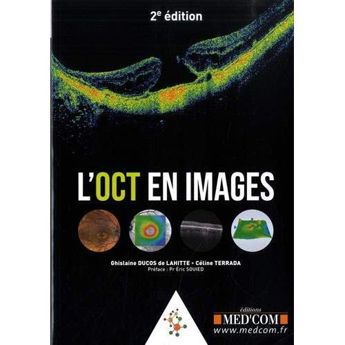 L'OCT en images. 2e édition
