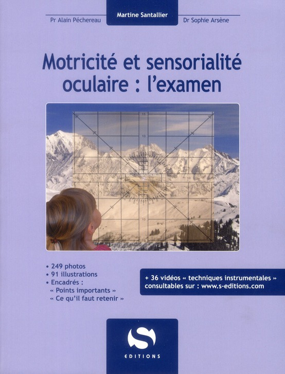Motricité et sensorialité oculaire : l'examen