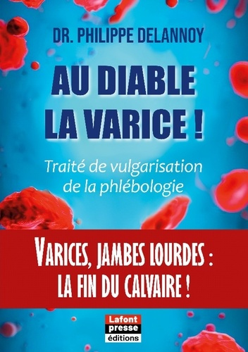 Au diable la varice !. Varices, jambes lourdes : la fin du calvaire !