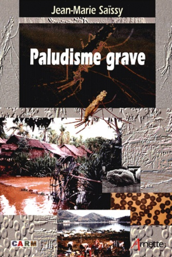 PALUDISME GRAVE