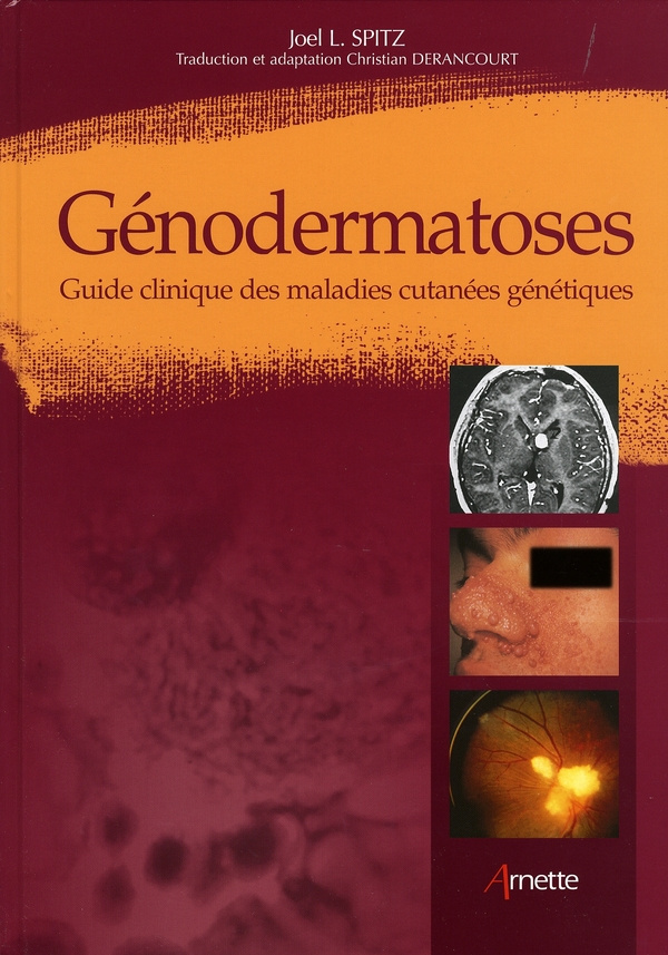 Génodermatoses. Guide clinique des maladies cutanées génétiques