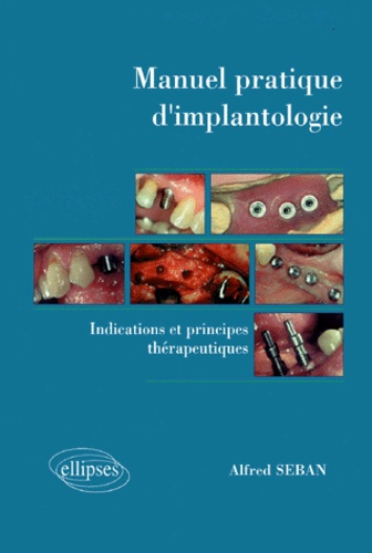 MANUEL PRATIQUE D'IMPLANTOLOGIE. Indications et principes thérapeutiques