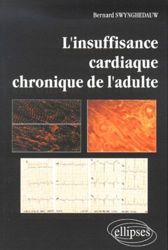 L'insuffisance cardiaque chronique de l'adulte