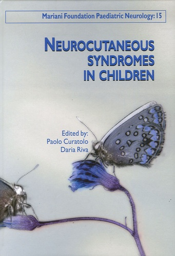 Neurocutaneous syndromes in children
