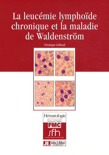 LA LEUCEMIE LYMPHOIDE CHRONIQUE ET LA MALADIE DE WALDENSTROM
