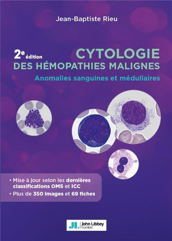 Cytologie des hémopathies malignes. Anomalies sanguines et médullaires