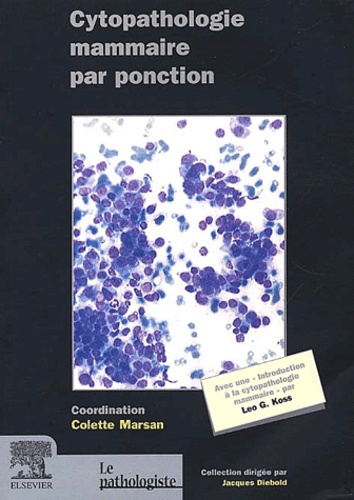 Cytopathologie mammaire par ponction