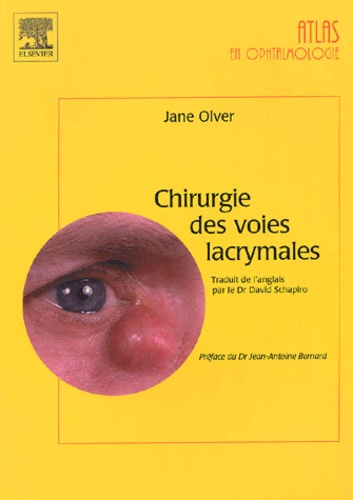 Chirurgie des voies lacrymales