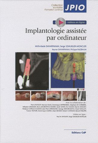 Implantologie assistée par ordinateur