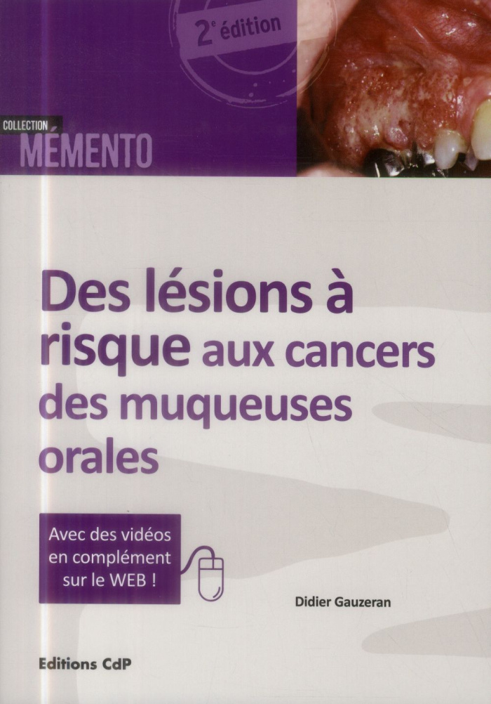 Des lésions à risque aux cancers des muqueuses orales. 2e édition