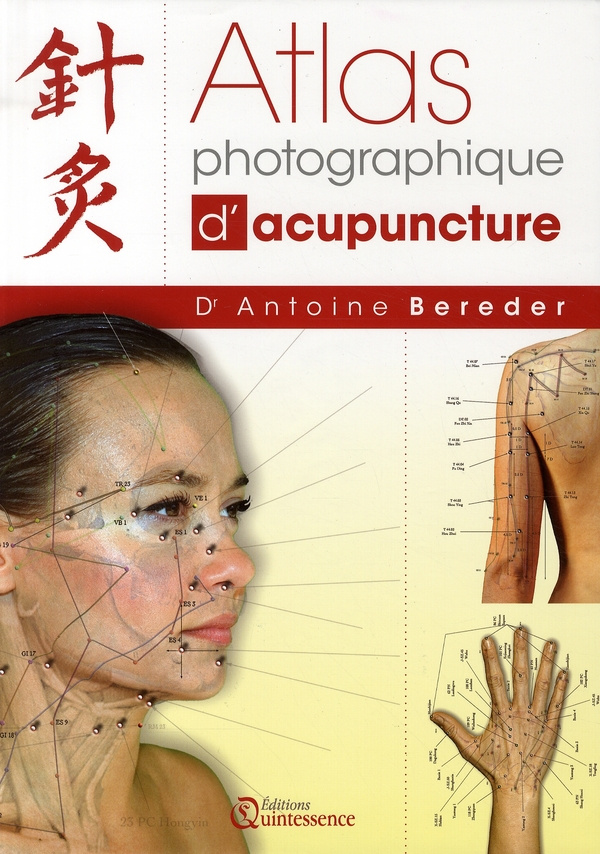 Atlas photographique d'acupuncture