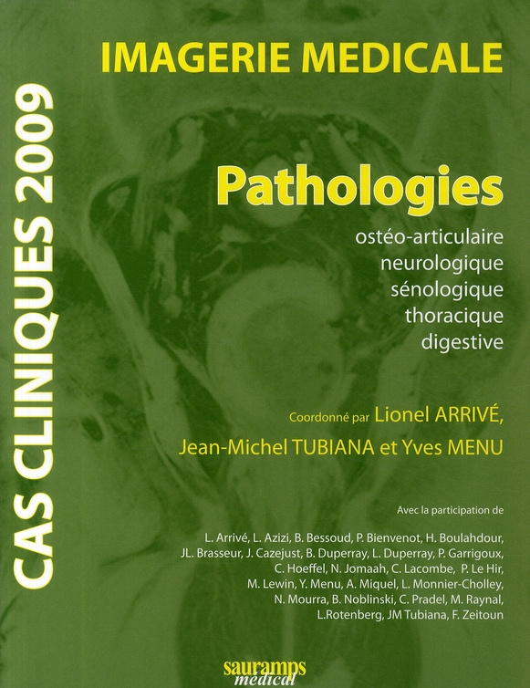 Arriv_Lionel_Tubiana_Jean-Michel_Menu_Yves-Imagerie_m_dicale._Pathologies_Edition_2009-9782840236030_0