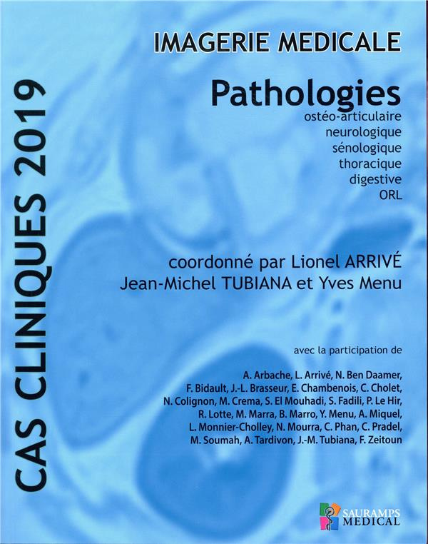Arriv_Lionel_Tubiana_Jean-Michel_Menu_Yves-Imagerie_m_dicale._Pathologies_ost_o-articulaire_neurologique_s_nologique_thoracique_digestive_-9791030301939_0