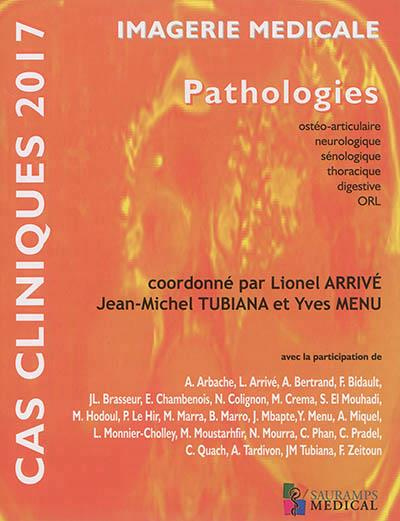 Arriv_Lionel_Tubiana_Jean-Michel_Menu_Yves-Imagerie_m_dicale._Pathologies_ost_oarticulaire_neurologique_s_nologique_thoracique_digestive_O-9791030300888_0