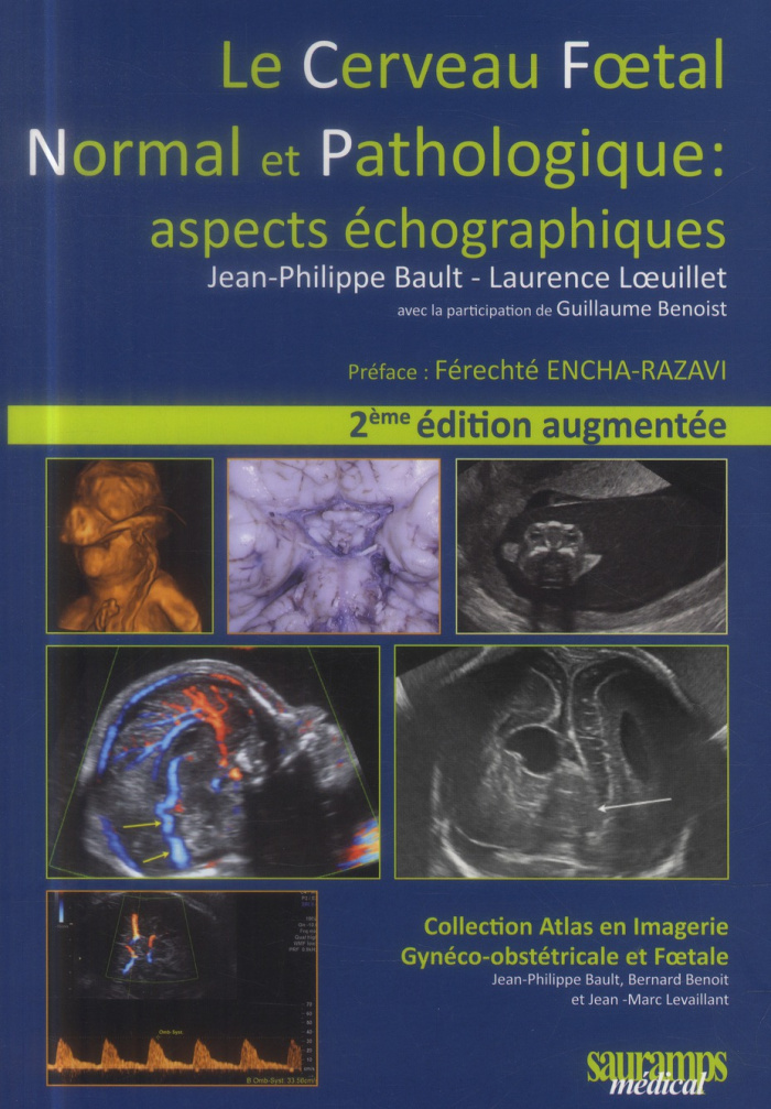 Bault_Jean-Philippe_Loeuillet_Laurence_Benoist-Le_cerveau_foetal_normal_et_pathologique_aspects_chographiques._2e_dition_revue_et_augment_e-9782840239239_0