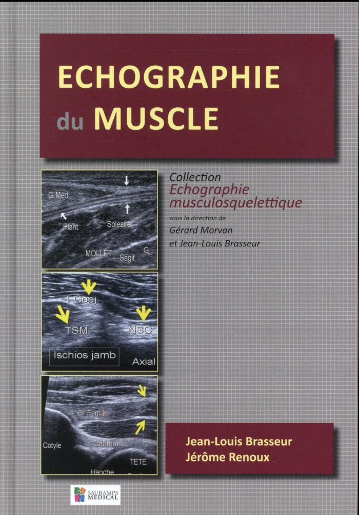 Brasseur_Jean-Louis_Renoux_J_r_me_Masein_Audre-Echographie_du_muscle-9791030300499_0