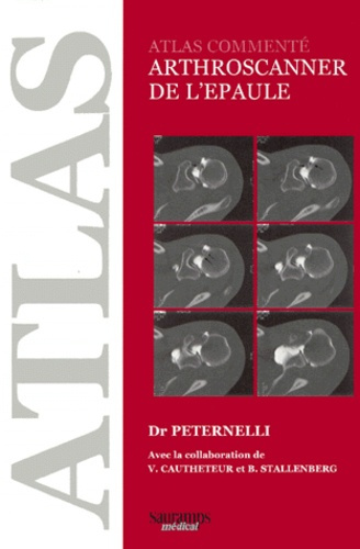 Caucheteur_V-ARTHROSCANNER_DE_L_EPAULE._Atlas_comment_-9782840232018_0