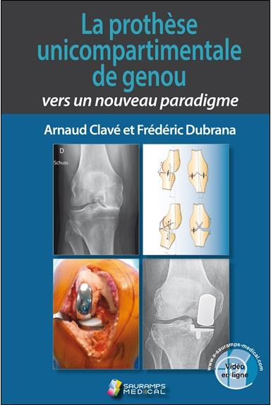 Clav_Arnaud_Dubrana_Fr_d_ric-La_proth_se_unicompartimentale_de_genou_vers_un_nouveau_paradigme-9791030302752_0