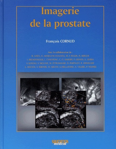 Cornud_Fran_ois-Imagerie_de_la_prostate-9782840234005_0