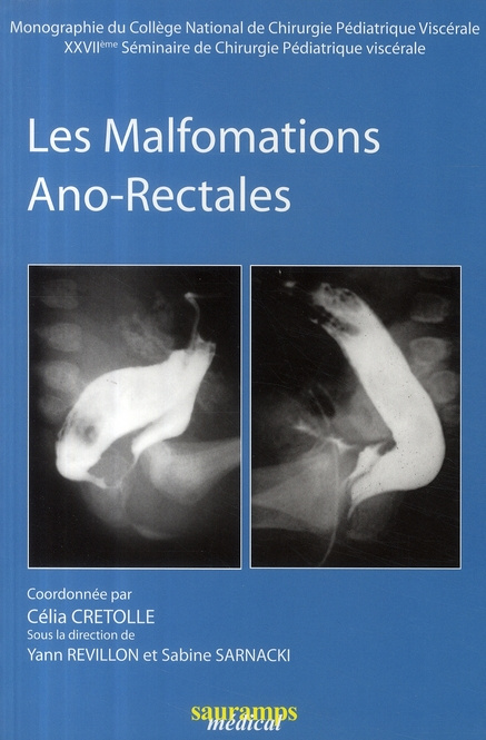 Cr_tolle_C_lia_Revillon_Yann_Sarnacki_Sabine-Les_malformations_Ano-Rectales._27e_s_minaire_de_chirurgie_p_diatrique_visc_rale-9782840236009_0