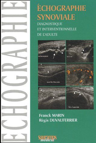 Duvauferrier_R_gis_Marin_Franck-Echographie_synoviale_diagnostique_et_interventionnelle_de_l_adulte-9782840233237_0