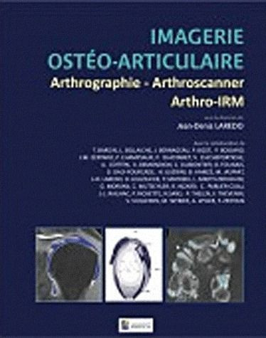 Laredo_Jean-Denis-Imagerie_ost_o-articulaire._Arthrographie_arthroscanner_arthro-IRM-9782840237433_0