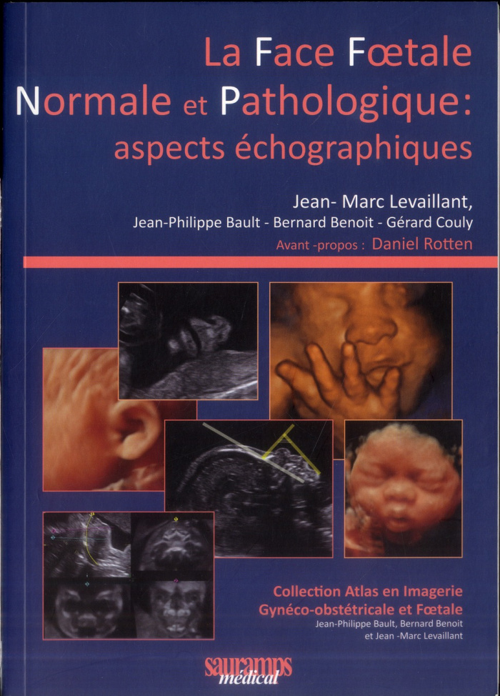 Levaillant_Jean-Marc_Bault_Jean-Philippe_Beno_-La_face_foetale_normale_et_pathologique_aspects_chographiques-9782840238690_0