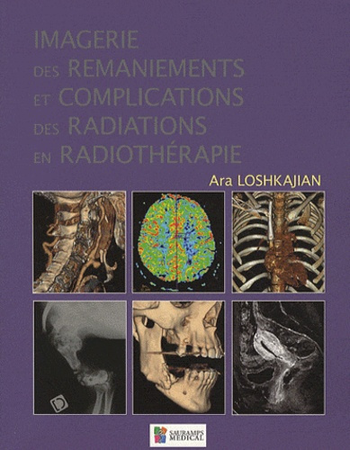 Loshkajian_Ara_Vanel_Daniel-Imagerie_des_remaniements_et_complications_des_radiations_en_radioth_rapie-9782840236429_0