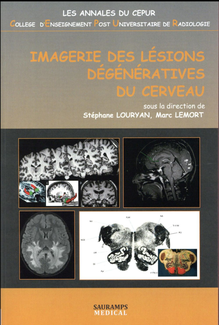 Louryan_St_phane_Lemort_Marc-Imagerie_des_l_sions_d_g_n_ratives_du_cerveau-9791030300659_0