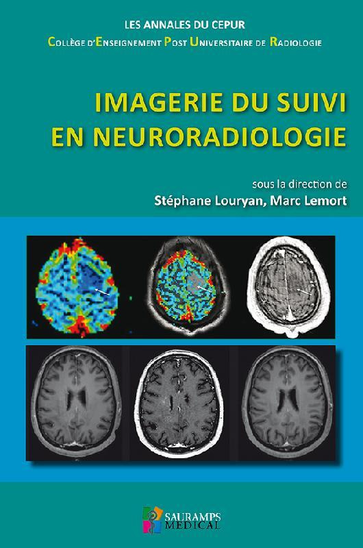 Louryan_St_phane_Lemort_Marc-Imagerie_du_suivi_en_neuroradiologie-9791030301724_0