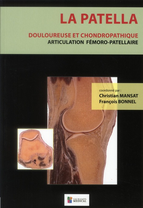 Mansat_Christian_Bonnel_Fran_ois-La_patella_douloureuse_et_chondropathique._Articulation_f_moro-patellaire-9782840237297_0