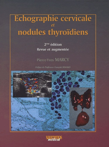 Marcy_Pierre-Yves-Echographie_cervicale_et_nodules_thyro_diens._2e_dition_revue_et_augment_e-9782840233947_0