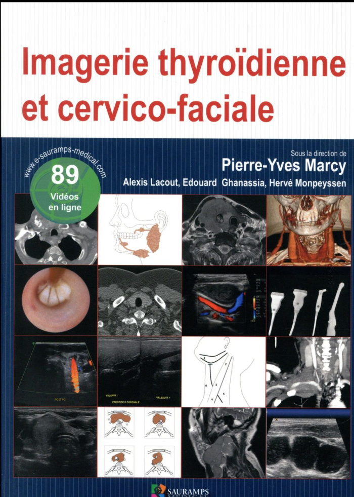 Marcy_Pierre-Yves_Lacout_Alexis_Ghanassia_Edou-Imagerie_thyroidienne_et_cervico-faciale-9791030301366_0