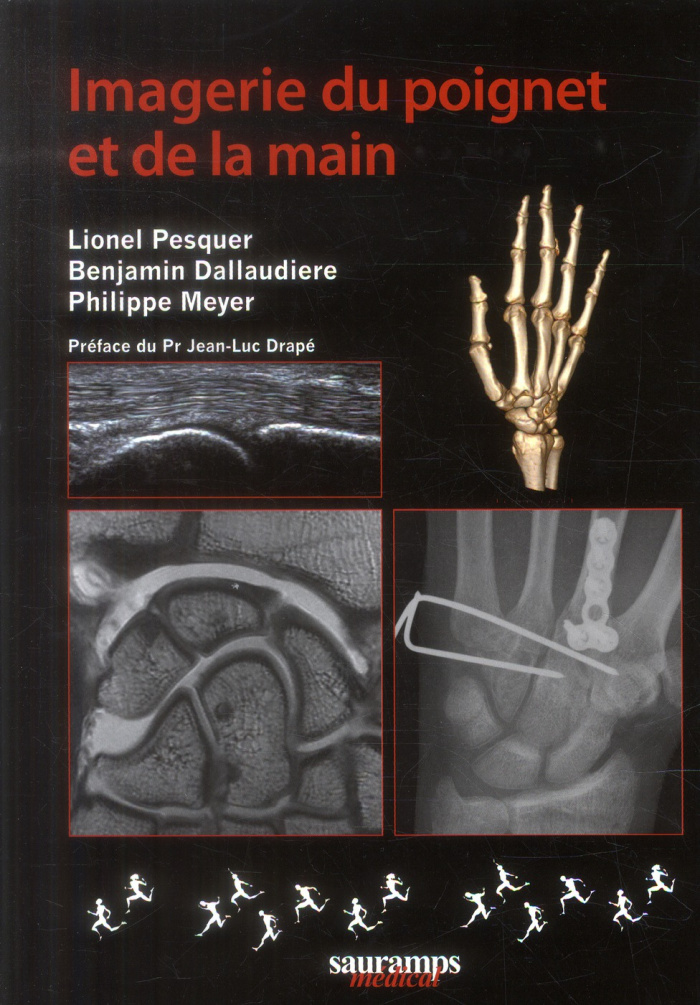 Pesquer_Lionel_Dallaudi_re_Benjamin_Meyer_Phil-Imagerie_du_poignet_et_de_la_main-9782840238980_0