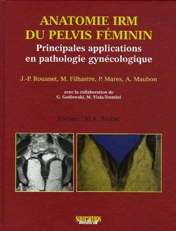 Rouanet_de_Lavit_Jean-Pierre_Filhastre_M_Mar_s-Anatomie_IRM_du_pelvis_f_minin._Principales_applications_en_pathologie_gyn_cologique-9782840234418_0