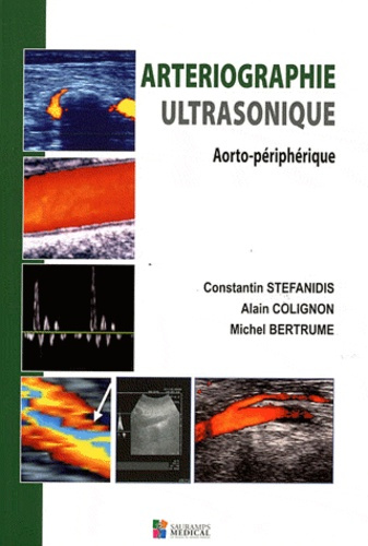 Stefanidis_Constantin_Colignon_Alain_Bertrum_-Arteriographie_ultrasonique._Aorto-p_riph_rique-9782840237488_0